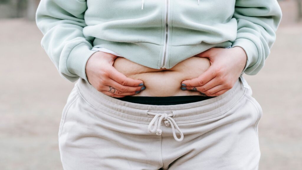 What are the 3 different types of obesity? Causes and Symptoms